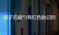 孩子后脑勺有红色胎记的原因有哪些